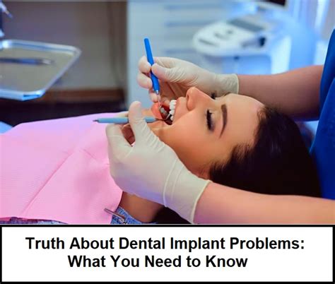 will caresource cover dental implants|Uncovering the Truth: Does Caresource Truly Cover Dental。